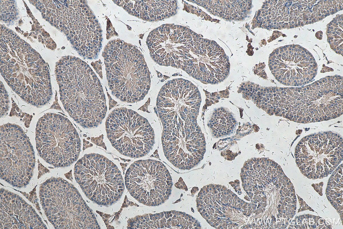 IHC staining of mouse testis using 20482-1-AP