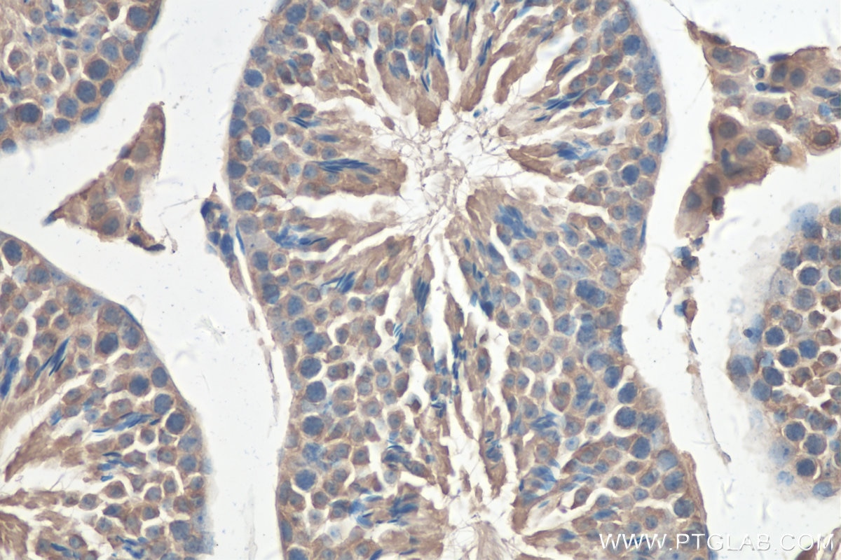 Immunohistochemistry (IHC) staining of mouse testis tissue using TBC1D17 Polyclonal antibody (20482-1-AP)