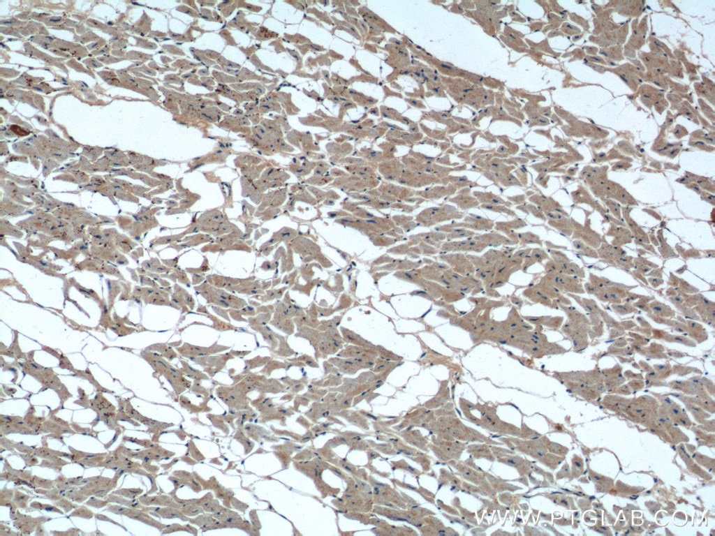 Immunohistochemistry (IHC) staining of human heart tissue using TBC1D17 Polyclonal antibody (20482-1-AP)