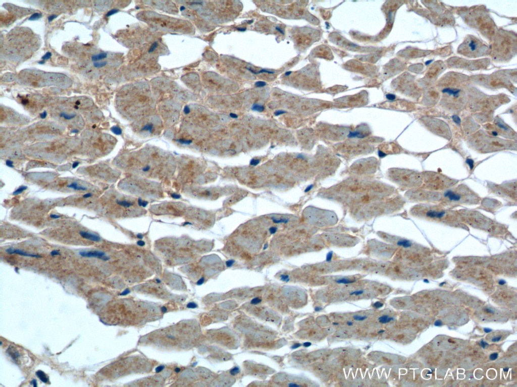 Immunohistochemistry (IHC) staining of human heart tissue using TBC1D17 Polyclonal antibody (20482-1-AP)