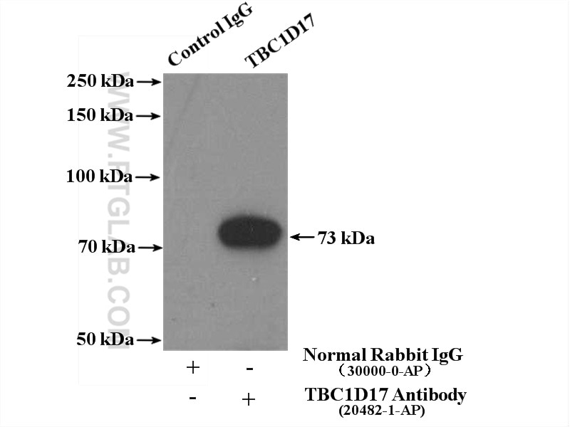 Immunoprecipitation (IP) experiment of Jurkat cells using TBC1D17 Polyclonal antibody (20482-1-AP)