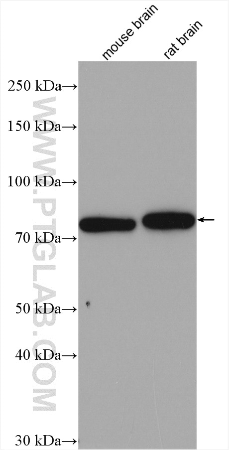 Western Blot (WB) analysis of various lysates using TBC1D17 Polyclonal antibody (20482-1-AP)