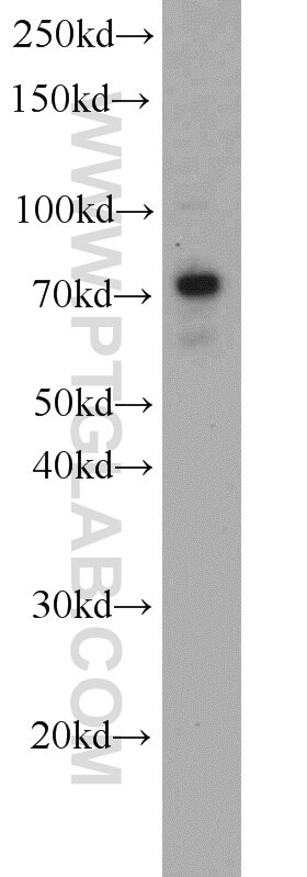 Western Blot (WB) analysis of mouse thymus tissue using TBC1D17 Polyclonal antibody (20482-1-AP)