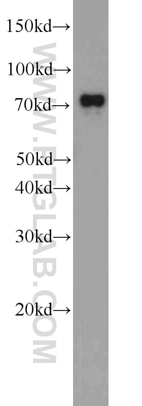 Western Blot (WB) analysis of Jurkat cells using TBC1D17 Polyclonal antibody (20482-1-AP)