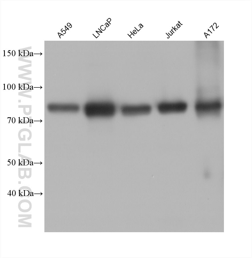 Western Blot (WB) analysis of various lysates using TBC1D17 Monoclonal antibody (60975-3-Ig)