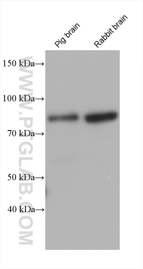 Western Blot (WB) analysis of various lysates using TBC1D17 Monoclonal antibody (60975-3-Ig)