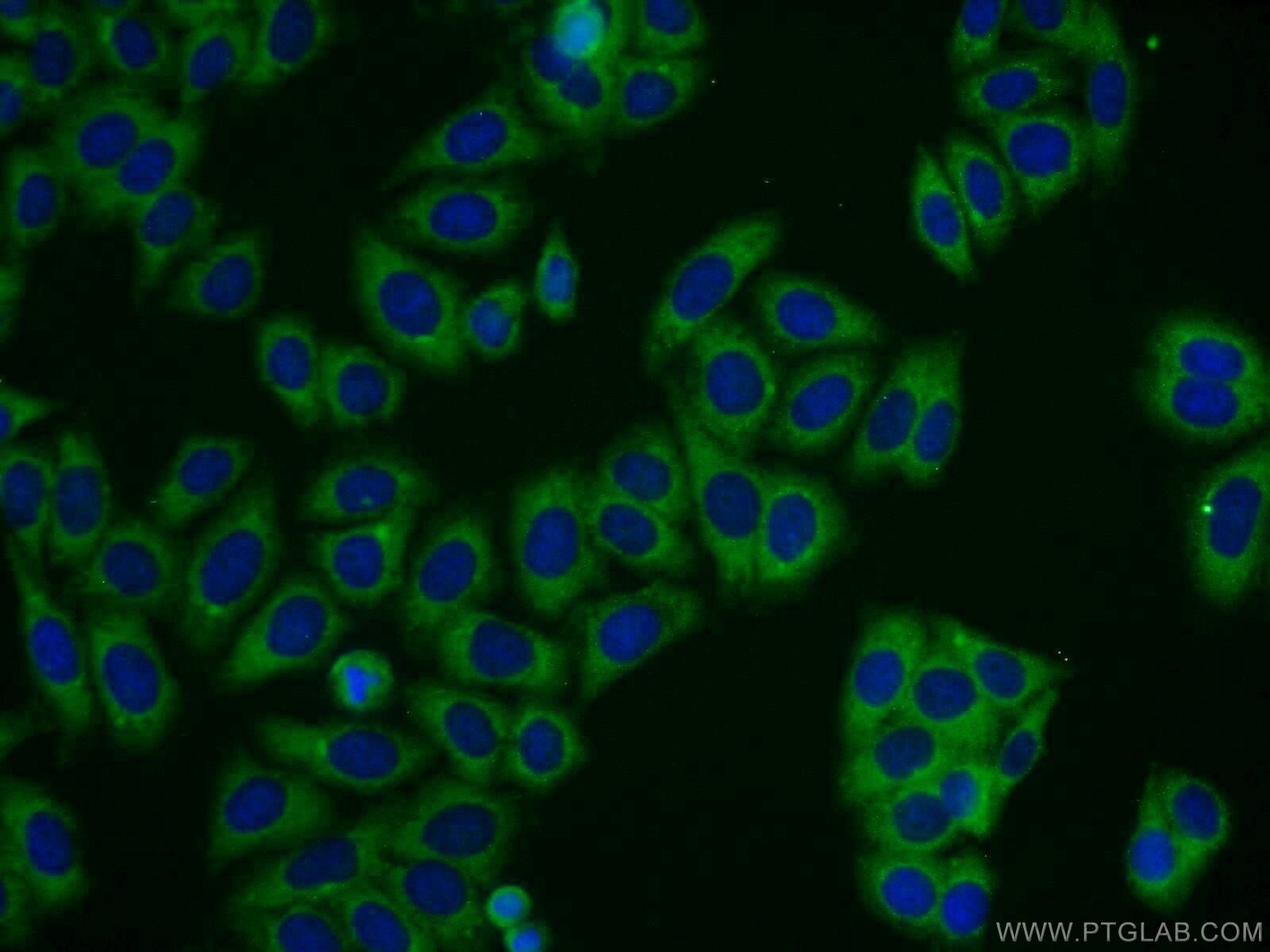 Immunofluorescence (IF) / fluorescent staining of HepG2 cells using TBC1D19 Polyclonal antibody (21085-1-AP)