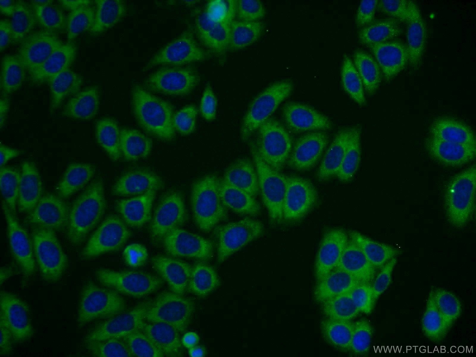 IF Staining of HepG2 using 21085-1-AP