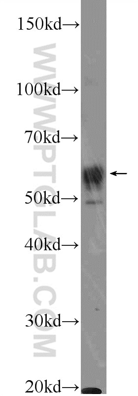 Western Blot (WB) analysis of rat brain tissue using TBC1D19 Polyclonal antibody (21085-1-AP)