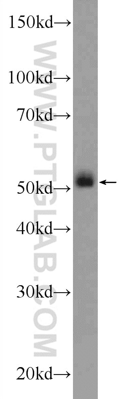Western Blot (WB) analysis of mouse brain tissue using TBC1D19 Polyclonal antibody (21085-1-AP)