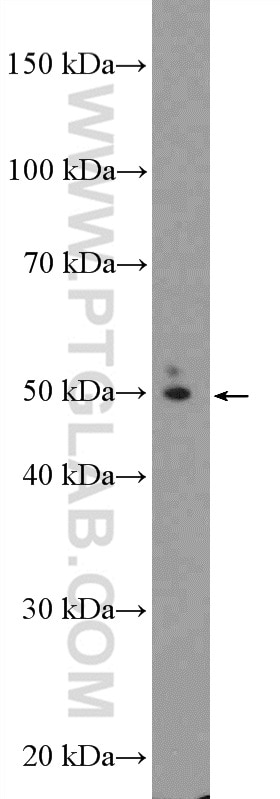 Western Blot (WB) analysis of mouse brain tissue using TBC1D19 Polyclonal antibody (21085-1-AP)