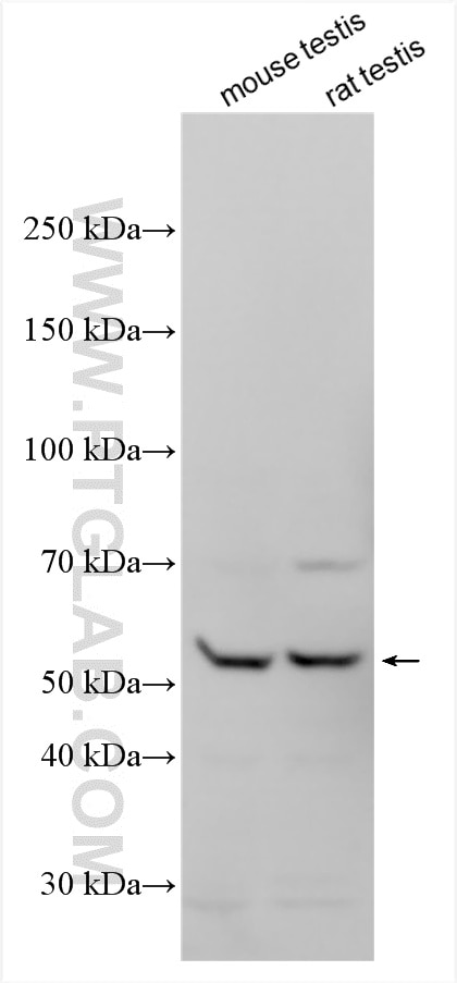 WB analysis using 21085-1-AP Western Blot (WB) analysis of various lysates using TBC1D19 Polyclonal antibody (21085-1-AP)