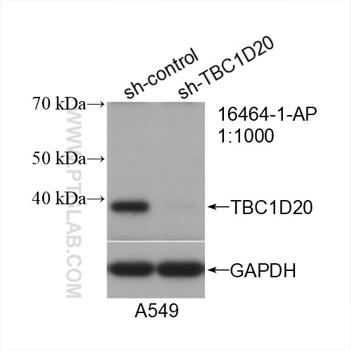 Western Blot (WB) analysis of A549 cells using TBC1D20 Polyclonal antibody (16464-1-AP)