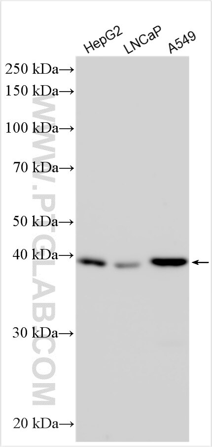 Western Blot (WB) analysis of various lysates using TBC1D20 Polyclonal antibody (16464-1-AP)