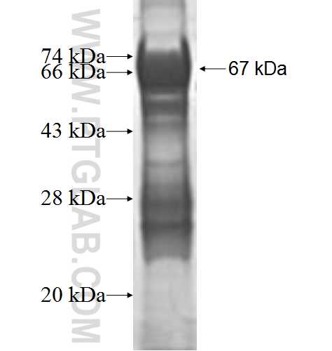 TBC1D20 fusion protein Ag9539 SDS-PAGE