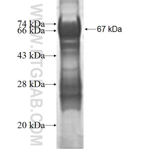TBC1D20 fusion protein Ag9539 SDS-PAGE