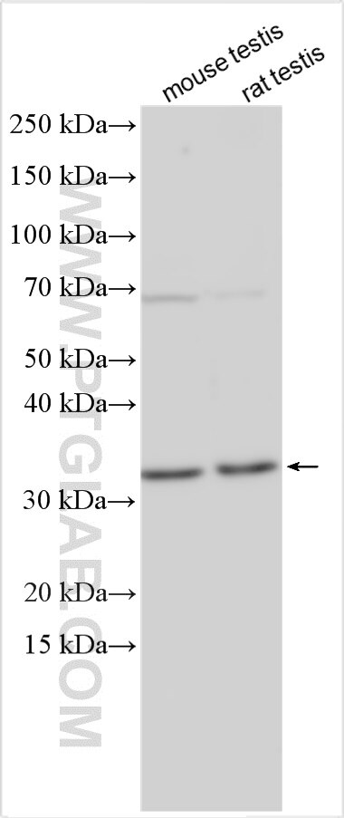 Western Blot (WB) analysis of various lysates using TBC1D21 Polyclonal antibody (17463-1-AP)