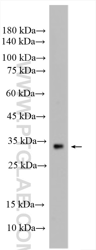 Western Blot (WB) analysis of rat testis tissue using TBC1D21 Polyclonal antibody (17463-1-AP)