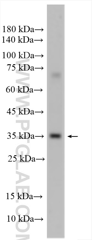 Western Blot (WB) analysis of mouse testis tissue using TBC1D21 Polyclonal antibody (17463-1-AP)