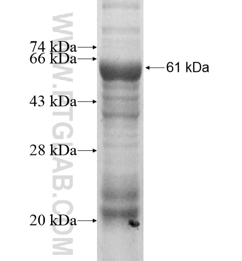 TBC1D21 fusion protein Ag11301 SDS-PAGE