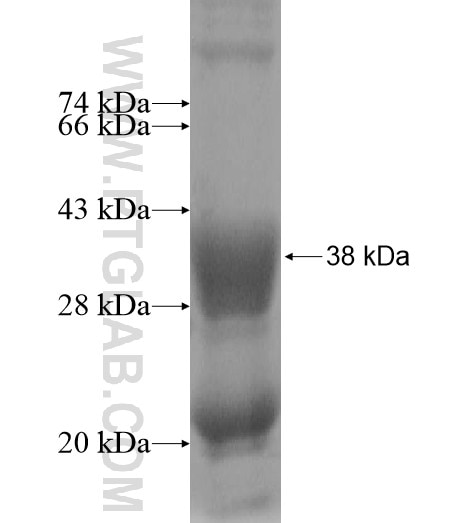 TBC1D21 fusion protein Ag11331 SDS-PAGE