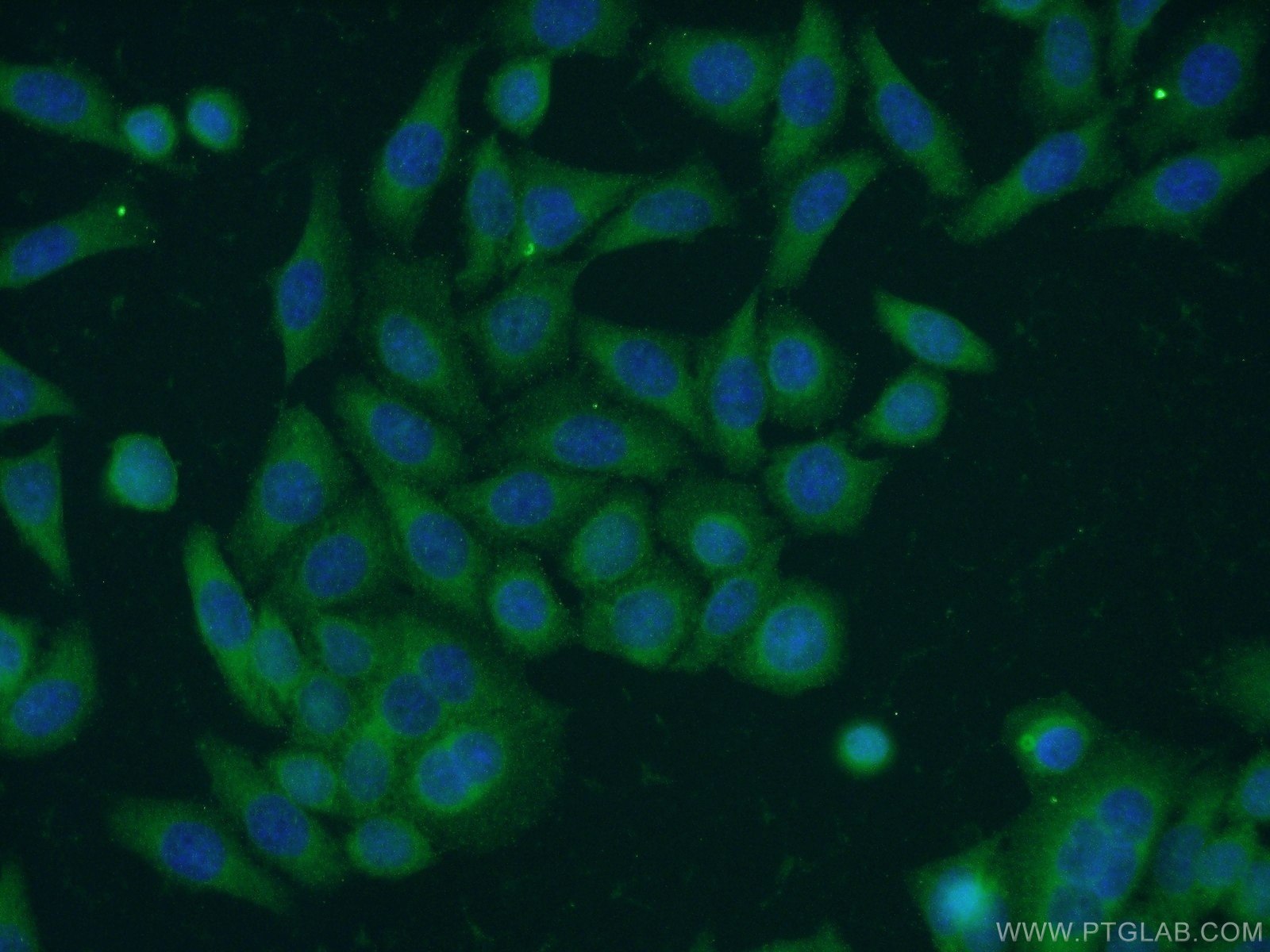 Immunofluorescence (IF) / fluorescent staining of HeLa cells using TBC1D22A Polyclonal antibody (18332-1-AP)