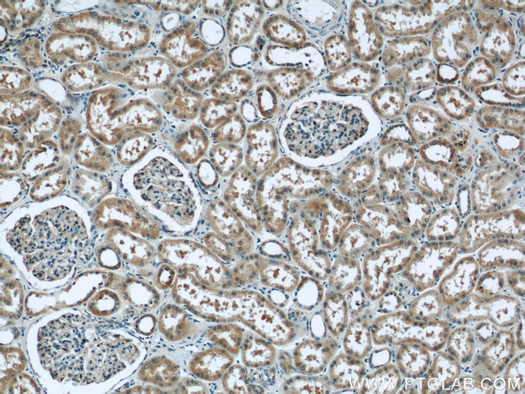 Immunohistochemistry (IHC) staining of human kidney tissue using TBC1D22A Polyclonal antibody (18332-1-AP)