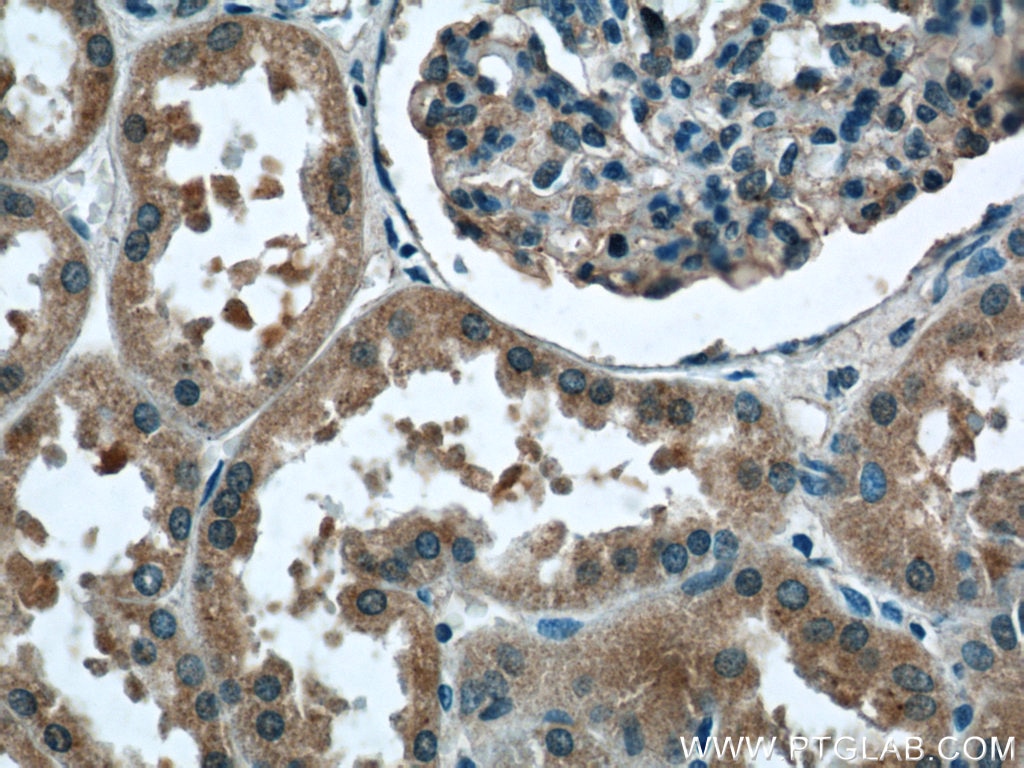 IHC staining of human kidney using 18332-1-AP