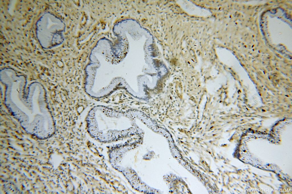 Immunohistochemistry (IHC) staining of human cervix tissue using TBC1D22A Polyclonal antibody (18332-1-AP)