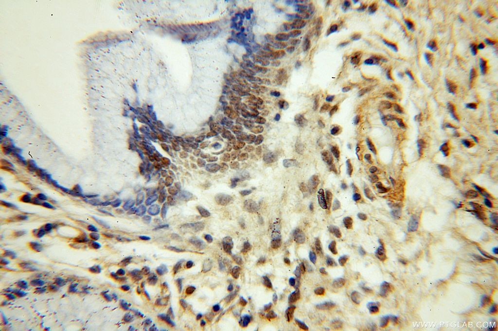 Immunohistochemistry (IHC) staining of human cervix tissue using TBC1D22A Polyclonal antibody (18332-1-AP)