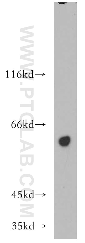 Western Blot (WB) analysis of HeLa cells using TBC1D22A Polyclonal antibody (18332-1-AP)
