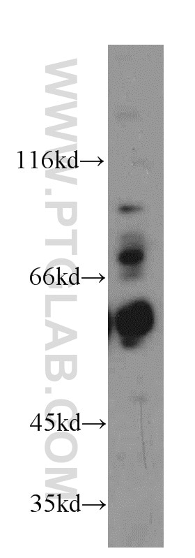Western Blot (WB) analysis of HeLa cells using TBC1D22A Polyclonal antibody (18332-1-AP)