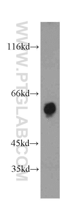 Western Blot (WB) analysis of COLO 320 cells using TBC1D22A Polyclonal antibody (18332-1-AP)