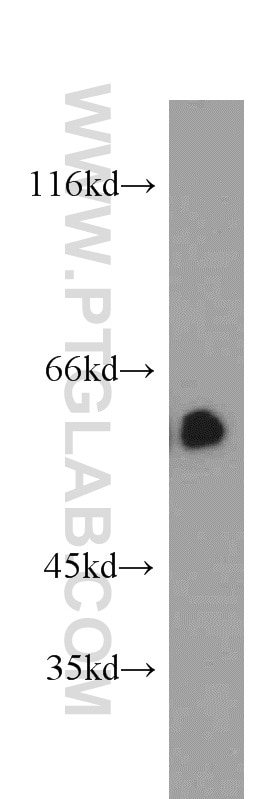 Western Blot (WB) analysis of COLO 320 cells using TBC1D22A Polyclonal antibody (18332-1-AP)