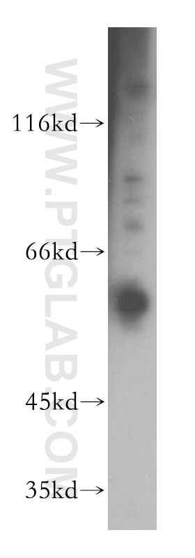 Western Blot (WB) analysis of HeLa cells using TBC1D22A Polyclonal antibody (18332-1-AP)