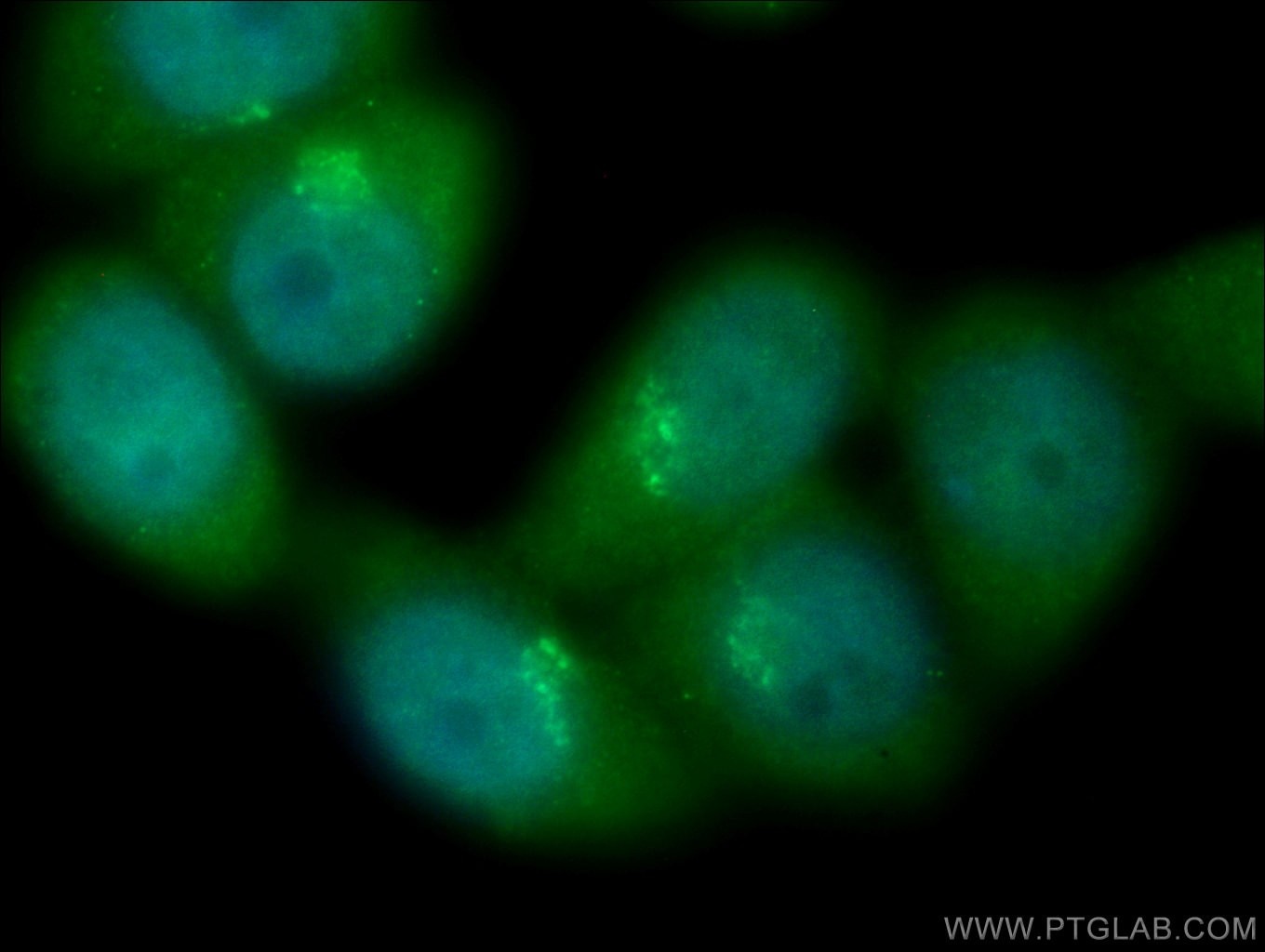 Immunofluorescence (IF) / fluorescent staining of HeLa cells using TBC1D23 Polyclonal antibody (17002-1-AP)