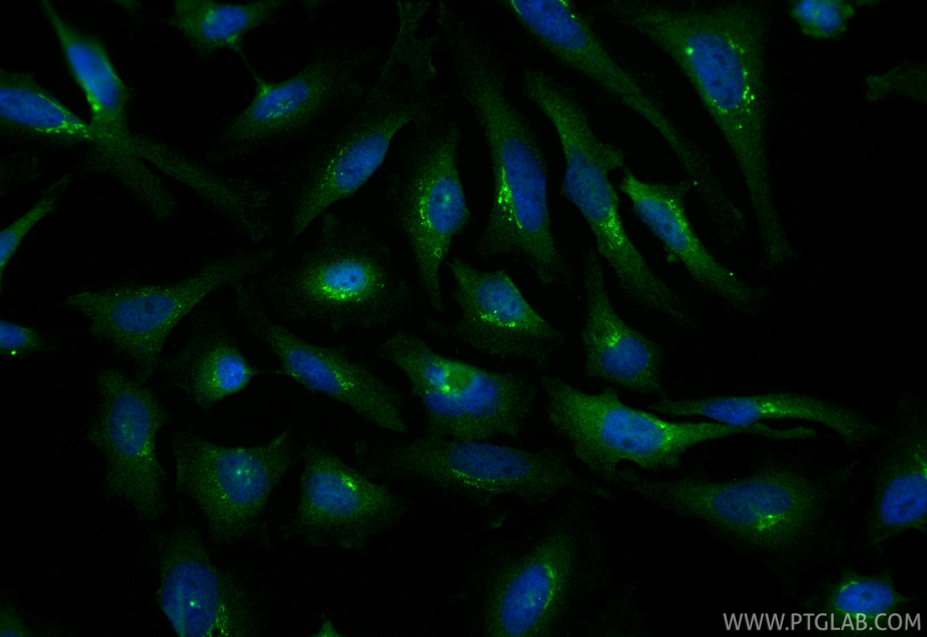 Immunofluorescence (IF) / fluorescent staining of HeLa cells using TBC1D23 Polyclonal antibody (17002-1-AP)