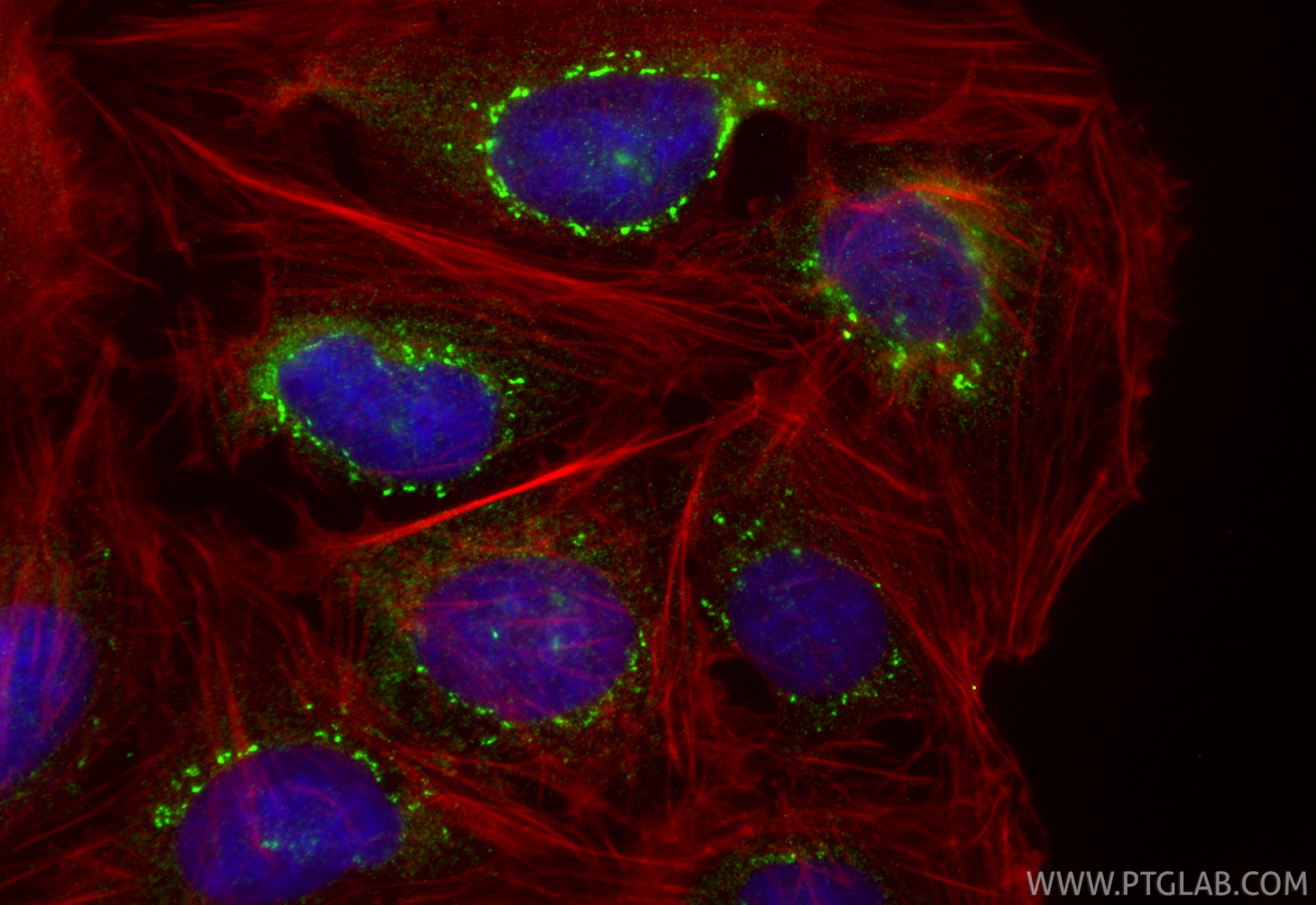 Immunofluorescence (IF) / fluorescent staining of U2OS cells using TBC1D23 Polyclonal antibody (17002-1-AP)