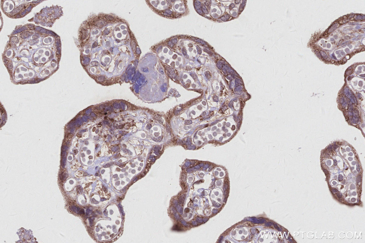 Immunohistochemistry (IHC) staining of human placenta tissue using TBC1D23 Polyclonal antibody (17002-1-AP)