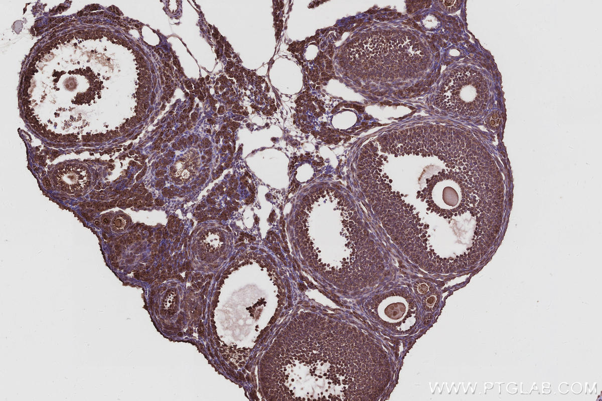 Immunohistochemistry (IHC) staining of mouse ovary tissue using TBC1D23 Polyclonal antibody (17002-1-AP)