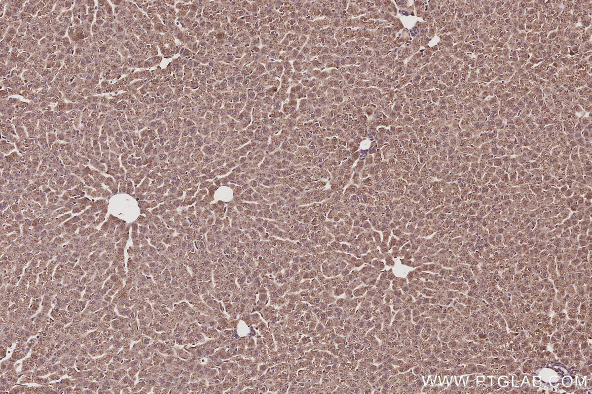 Immunohistochemistry (IHC) staining of rat liver tissue using TBC1D23 Polyclonal antibody (17002-1-AP)