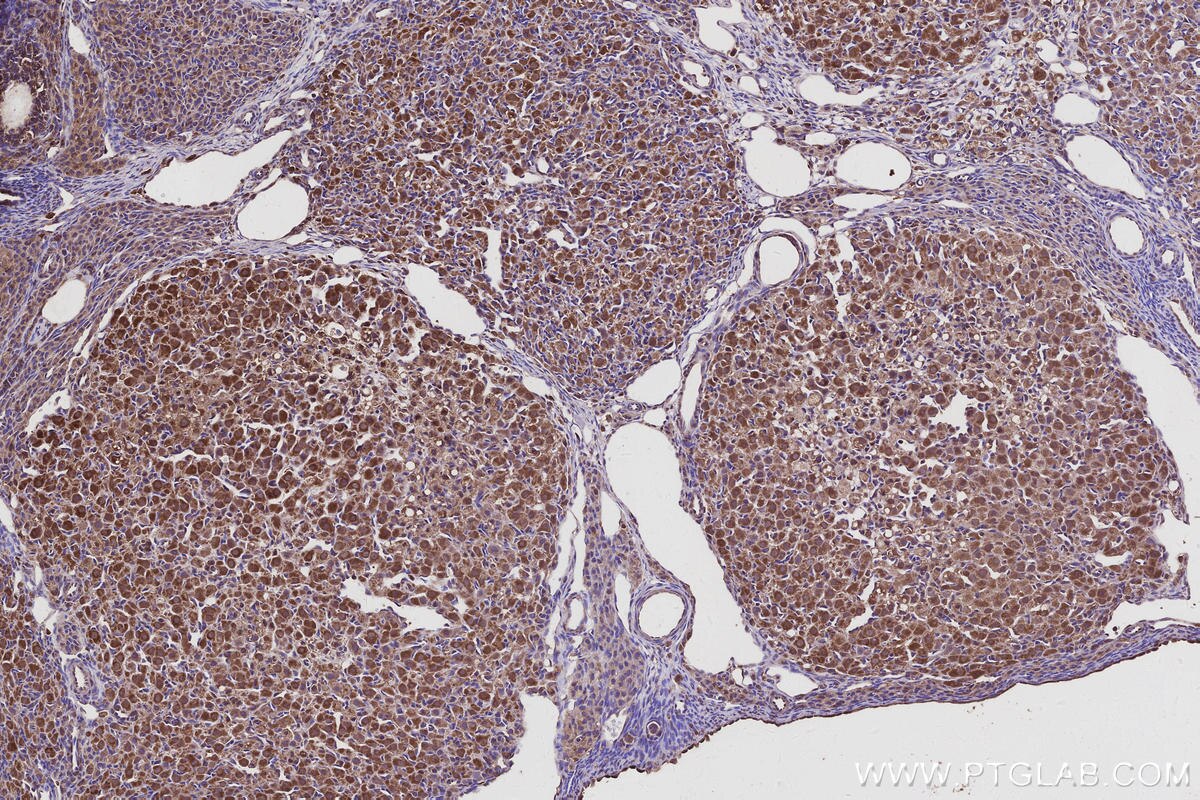 Immunohistochemistry (IHC) staining of rat ovary tissue using TBC1D23 Polyclonal antibody (17002-1-AP)