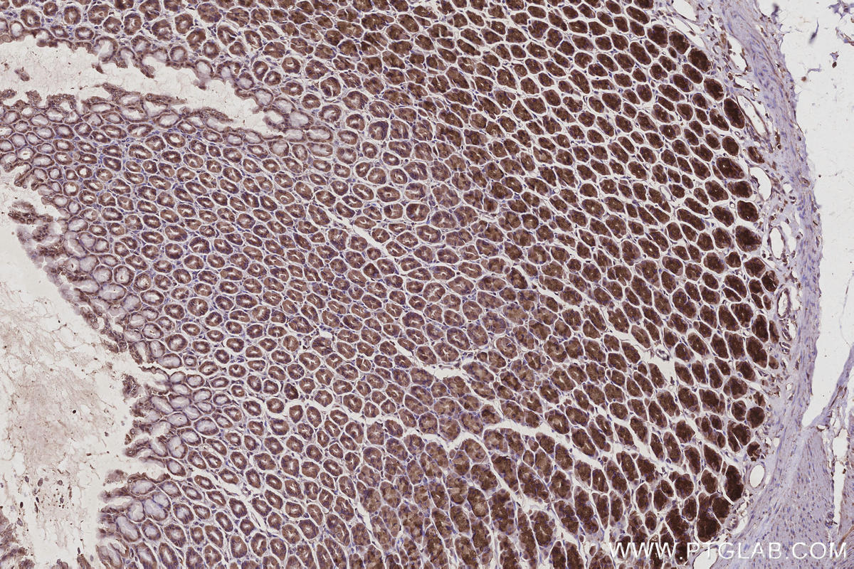 Immunohistochemistry (IHC) staining of rat stomach tissue using TBC1D23 Polyclonal antibody (17002-1-AP)