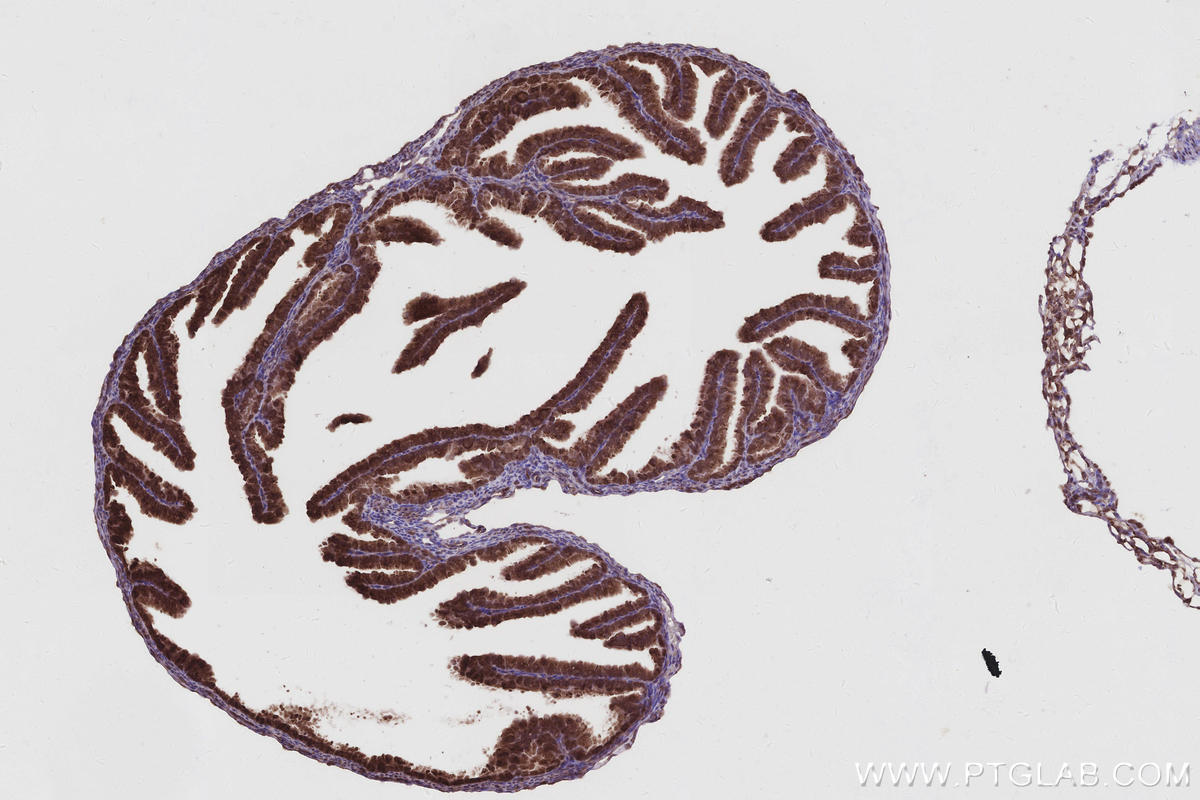 Immunohistochemistry (IHC) staining of mouse ovary tissue using TBC1D23 Polyclonal antibody (17002-1-AP)