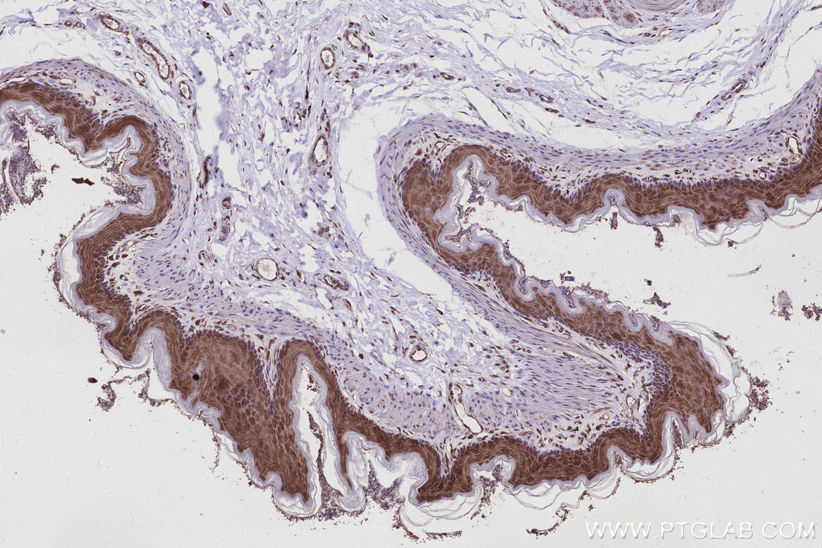 Immunohistochemistry (IHC) staining of rat stomach tissue using TBC1D23 Polyclonal antibody (17002-1-AP)