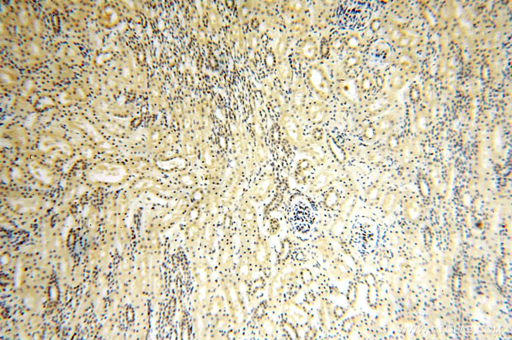 Immunohistochemistry (IHC) staining of human kidney tissue using TBC1D23 Polyclonal antibody (17002-1-AP)