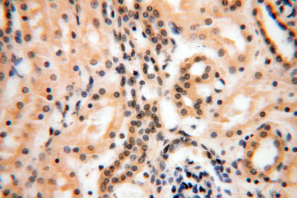 Immunohistochemistry (IHC) staining of human kidney tissue using TBC1D23 Polyclonal antibody (17002-1-AP)