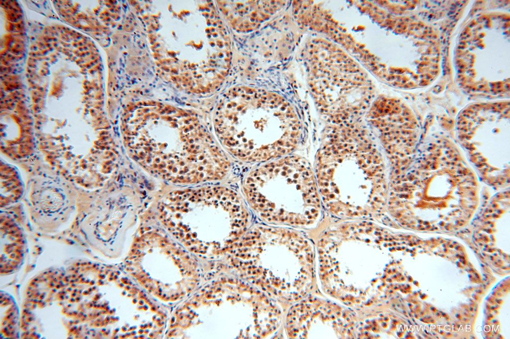 Immunohistochemistry (IHC) staining of human testis tissue using TBC1D23 Polyclonal antibody (17002-1-AP)