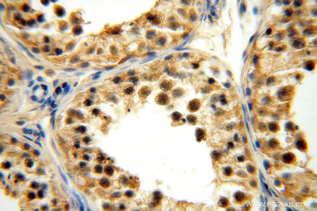 Immunohistochemistry (IHC) staining of human testis tissue using TBC1D23 Polyclonal antibody (17002-1-AP)