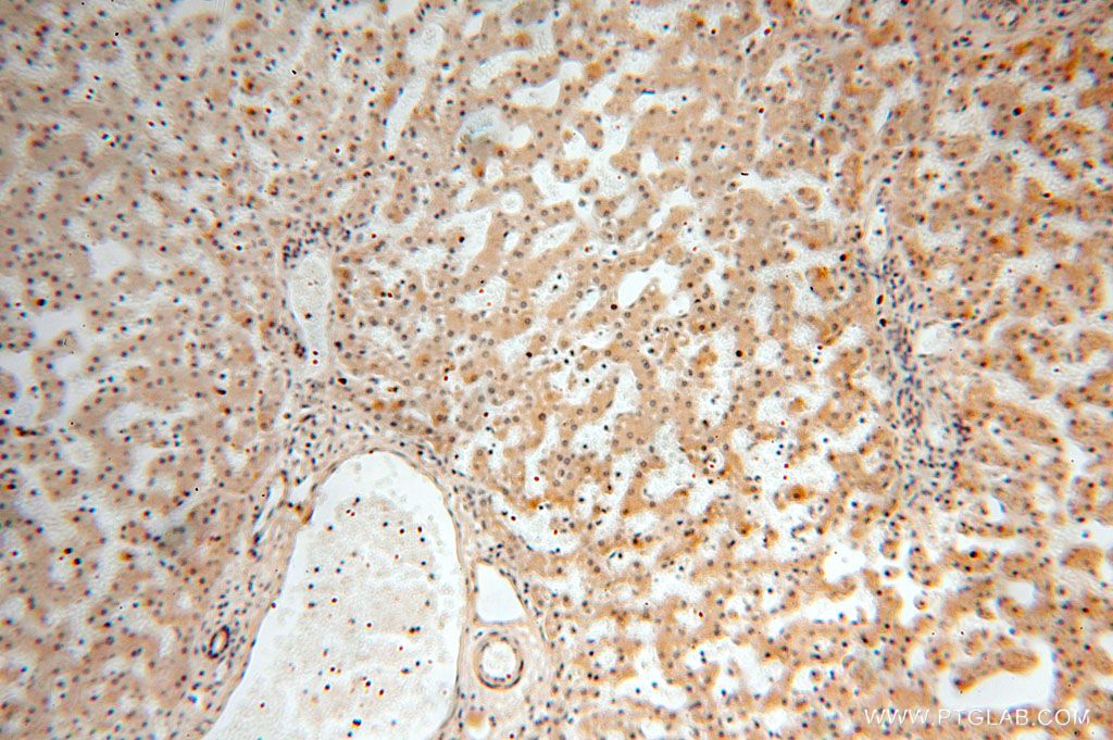 Immunohistochemistry (IHC) staining of human liver tissue using TBC1D23 Polyclonal antibody (17002-1-AP)